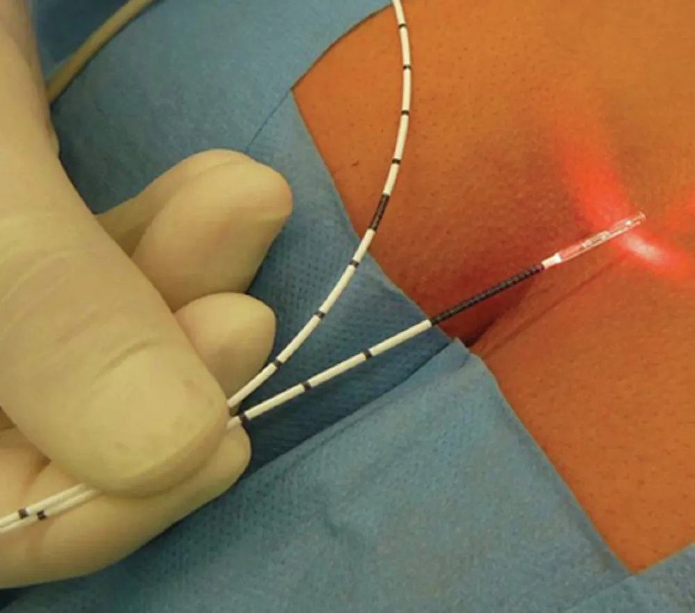 Dr. Sadhana V. Kendre and Shree Samarth Piles And Pain Clinic logo with laser surgery equipment